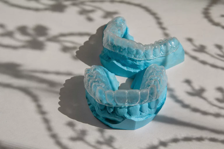 Dental retainer on a blue model of the teeth.