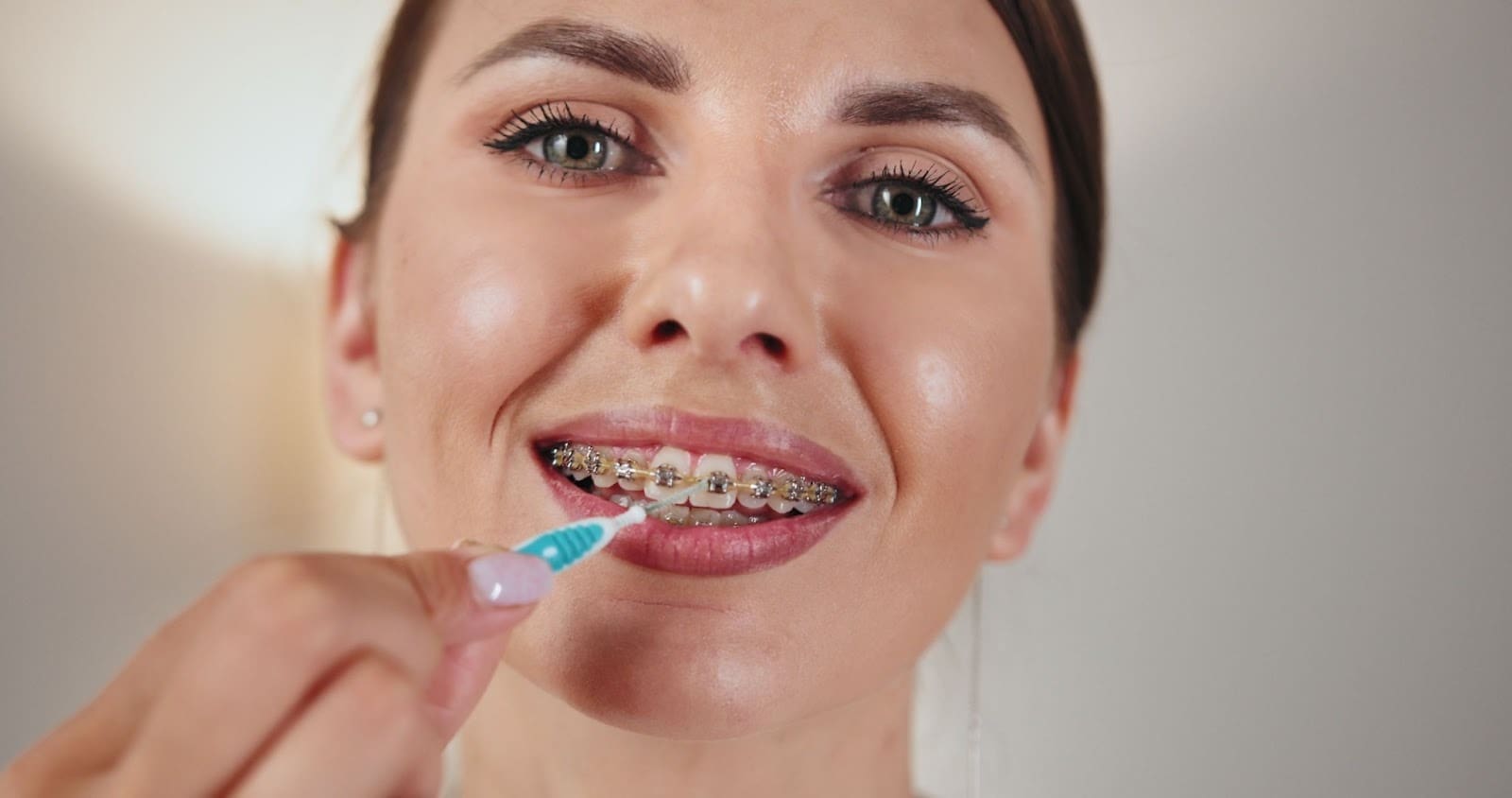 Close-up of a woman with braces using an interdental brush, demonstrating hygiene for Invisalign orthodontic treatment and effective scaling teeth cleaning service.