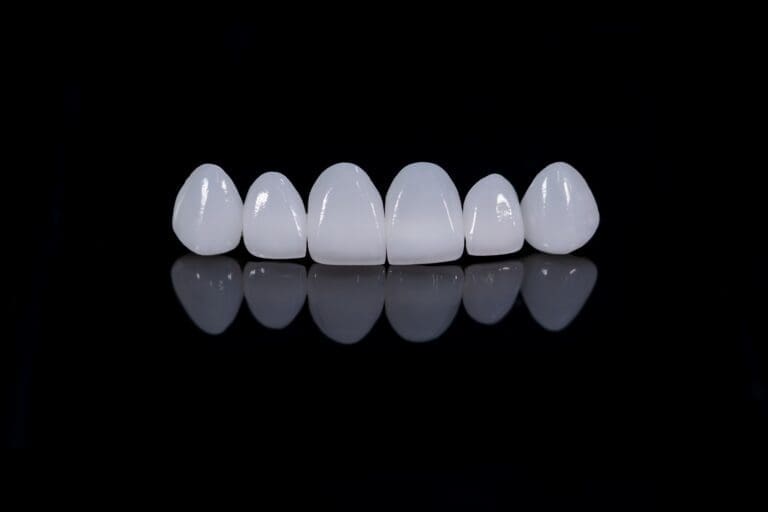 Six individual porcelain dental veneers, designed to replace the upper front teeth, arranged side-by-side on a glossy black surface with a reflective mirrored effect, showcasing the bright white color and translucent quality of the prosthetic teeth.