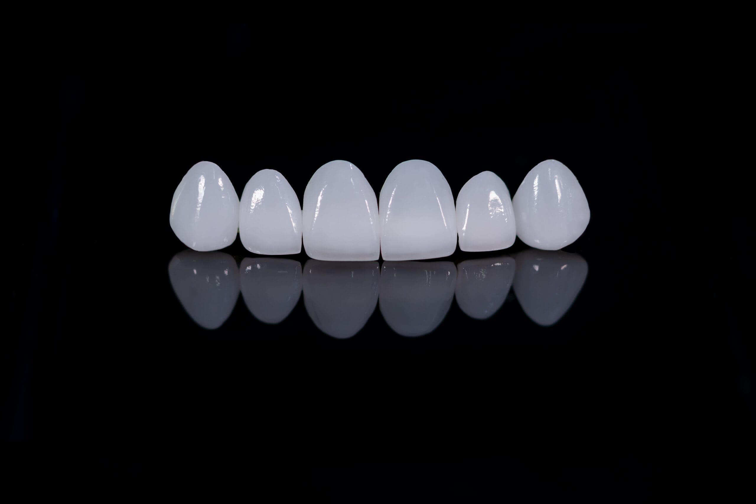 Six individual porcelain dental veneers, designed to replace the upper front teeth, arranged side-by-side on a glossy black surface with a reflective mirrored effect, showcasing the bright white color and translucent quality of the prosthetic teeth.
