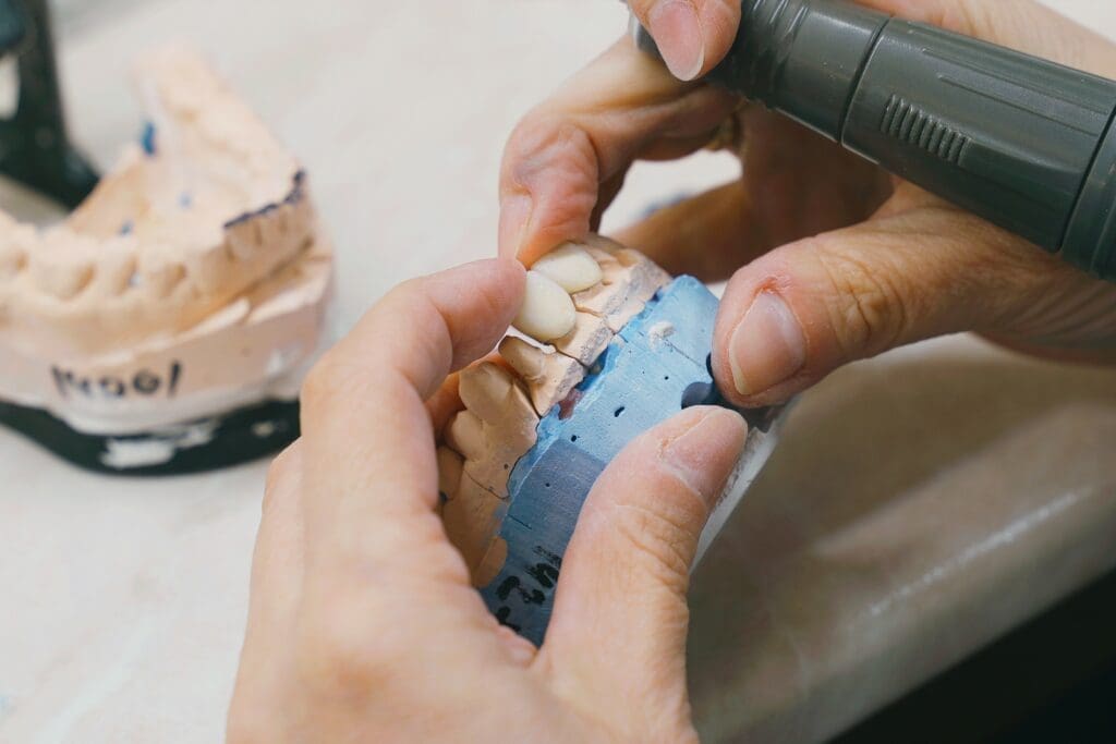 Close-up of a dental laboratory technician's hands using a small rotary handpiece to shape a white ceramic or composite tooth on a blue and pink plaster dental model. Focus on prosthetic dentistry and lab work.
