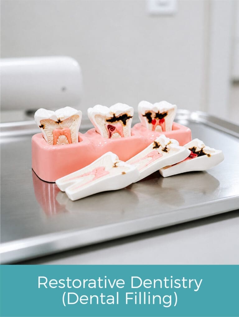restorative denstry dental filling