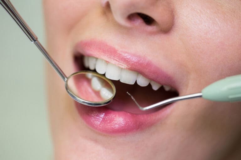 Dental Filling