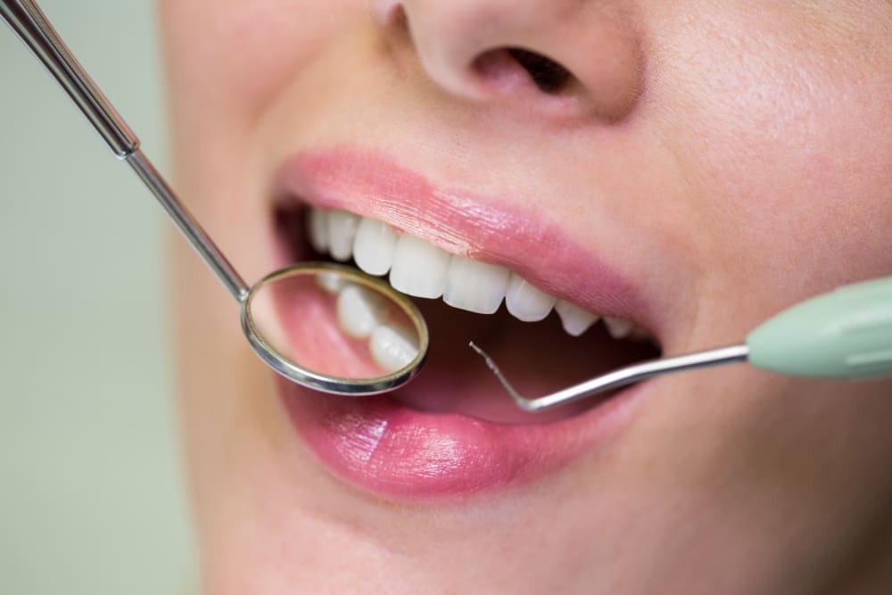Dental Filling